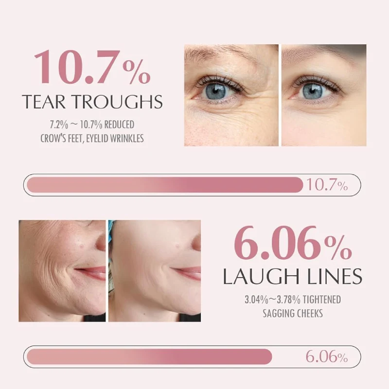 AHI Wrinkle Bounce Multi Balm Stick | PDRN Collagen Wrinkle Stick - Image 5